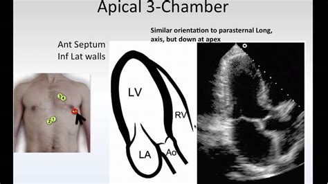 Introduction To Focused Cardiac Ultrasound Part Ii Youtube