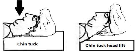 Chin tuck head lift exercise | Download Scientific Diagram