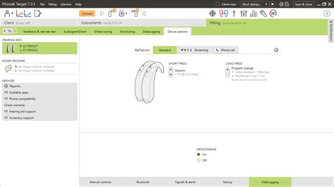 Phonak Target 7 3 1 Volume Behavior Hearing Aid Self Fitting And Adjusting [diy] Hearing Aid