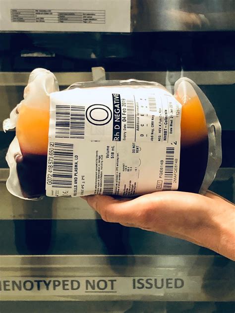 Labelled Blood Plasma at Julian Lentini blog