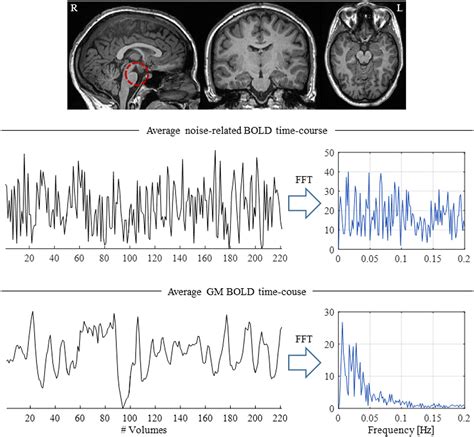 Frontiers Eeg Informed Fmri A Review Of Data Analysis Methods