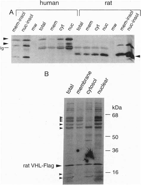 (A) Subcellular fractionation of VHL protein. COS-7 cells | Download ...