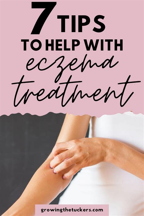 7 natural tips or products for eczema – Artofit