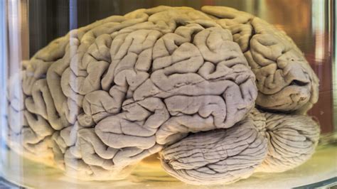 Inside The Worlds Largest Collection Of Preserved Human Brains In