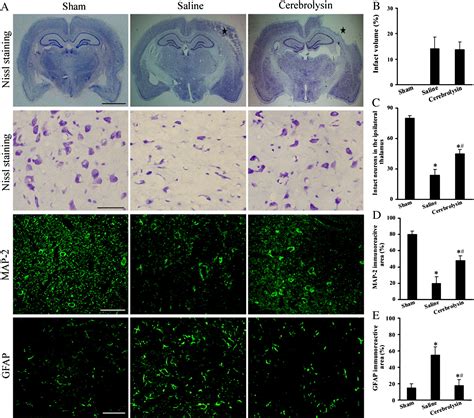 Cerebrolysin Reduces Amyloid Deposits Apoptosis And Autophagy In The