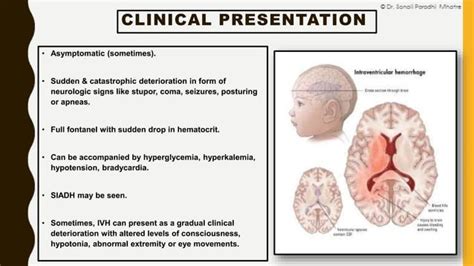 Neonatal Intracranial Hemorrhage By Dr Sonali Mhatre