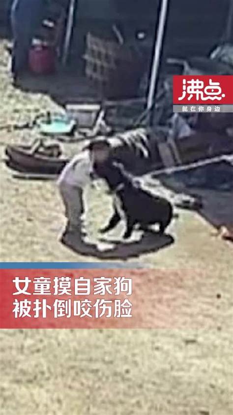 辽宁一女童摸自家狗反被扑倒咬伤脸 爸爸：给孩子打了疫苗 狗已经卖了 新浪新闻