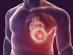 Triglyceride Lowering With Pemafibrate Risk Of Cardiovascular Events