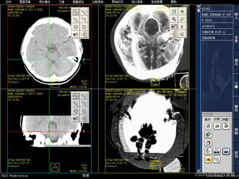 Pacs（ct、cr、dr、mr、dsa、rf医院影像管理系统源码） C 影像系统源码 Csdn博客