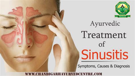 Ayurvedic Treatment For Sinusitis Symptoms Causes Diagnosis