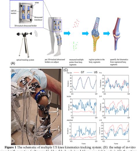 Figure 1 from A NOVEL TIBIOFEMORAL KINEMATICS MEASUREMENT SYSTEM BASED ...