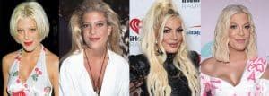 Tori Spelling Plastic Surgery Before and After Pictures 2024