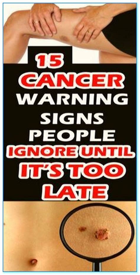 15 cancer symptoms – Artofit