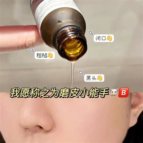 Hfp乳糖酸焕肤精华收缩毛孔粉刺原液修护毛孔粗大果酸男女虎窝淘