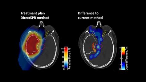 Imaging in Particle Therapy - Siemens Healthineers Danmark