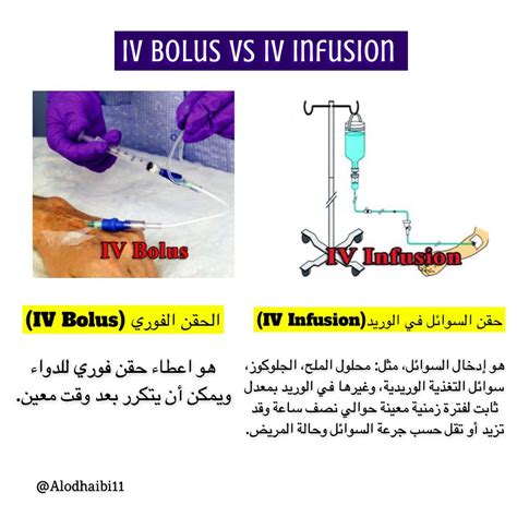 Iv Bolus Vs Iv Infusion Of Parenteral Drug Product 46 Off