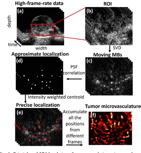 Figure 1 From A Combined Super Resolution Ultrasound Molecular Imaging