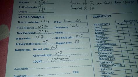 Low Sperm Motility Result - Health - Nigeria