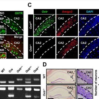 Deletion Of Oxtr In Ca Excitatory Neurons Of The Mouse Hippocampus A