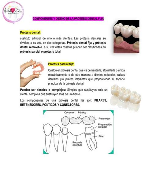 Componentes Y Dise O De La Pr Tesis Dental Fija Michelle Pedroza Udocz