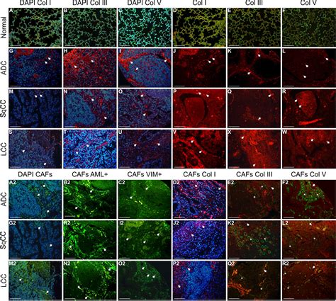 Frontiers In Situ Overexpression Of Matricellular Mechanical Proteins