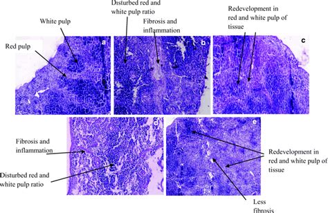 Spleen Histology Diagram