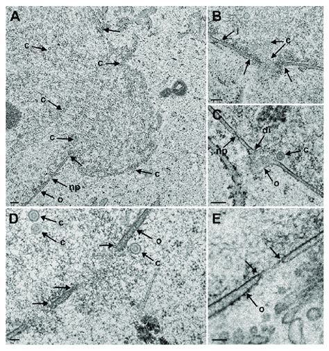 Transmission Electron Microscopy Tem Images Of Dilated Nuclear Pores