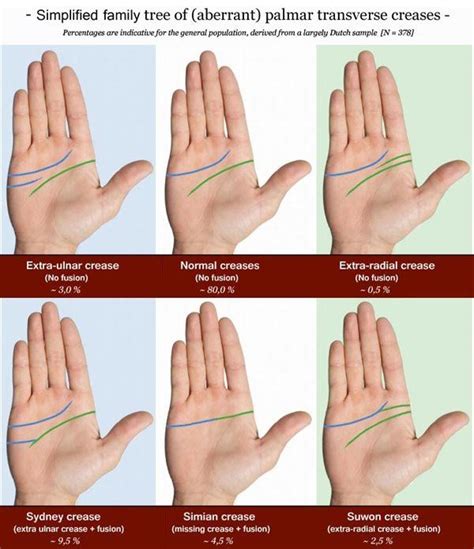 INTRO 1 14 About The Single Palmar Transverse Crease The Impact Of