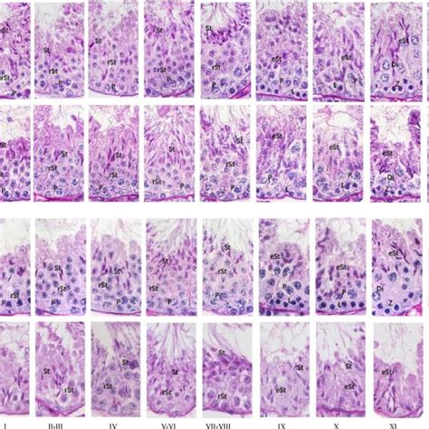 Pas Hematoxylin Stained Mouse Testis Showing Different Stages Of