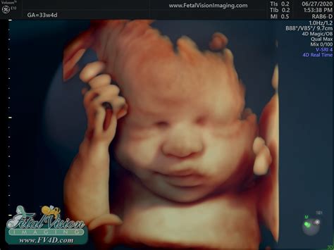 See Our New Ultrasound Machines Amazing 3d Visuals