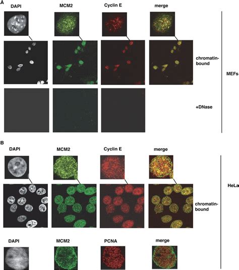 Localization Of Cyclin E On Chromatin A WT MEFs Were Subjected To In