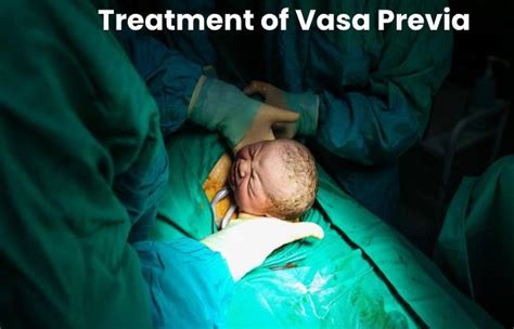 What is Vasa Previa? – Symptoms, Causes, Diagnosis, and More