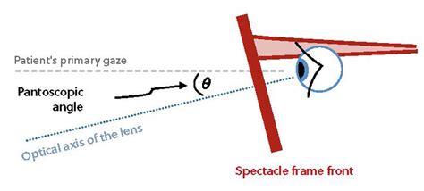 Troubleshooting Varifocals