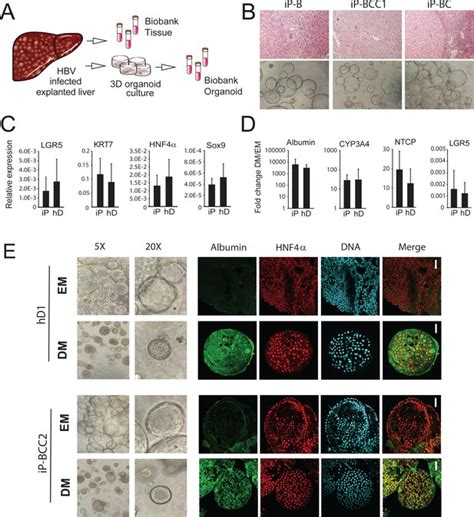 Application Of Human Liver Organoids As A Patient Derived Primary Model