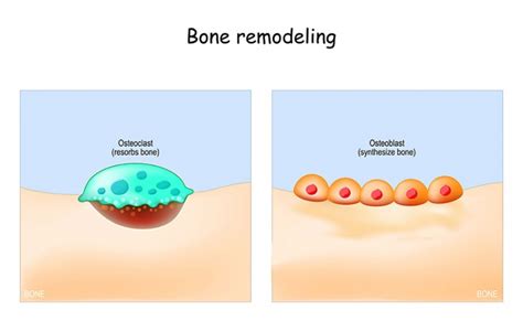 Osteoklasten Aufbau Funktion Krankheiten MedLexi De