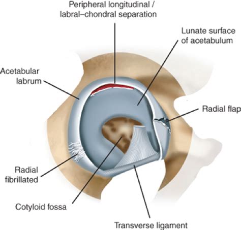 Acetabular Labrum