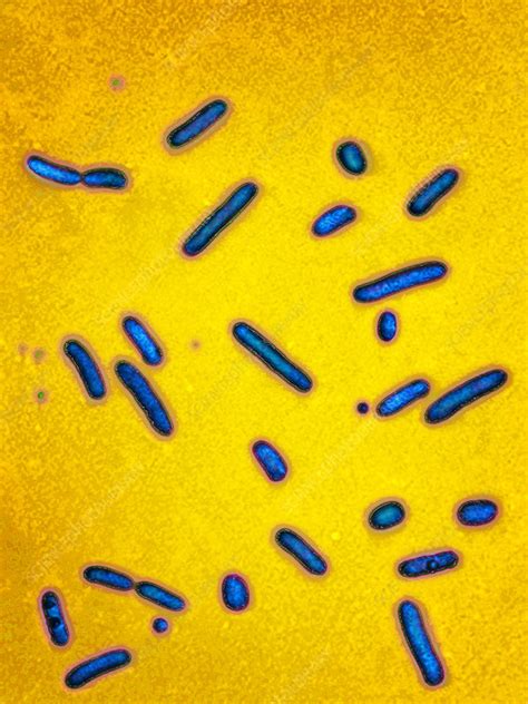 Pseudomonas Aeruginosa Bacteria Lm Stock Image C Science