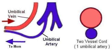 Soft Markers Fetal Ultrasound Centre