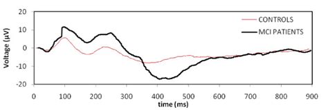 Grand Average Aerp Waveforms For Mci Patients N And Controls N