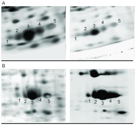 Enlarged Sections Of 2 De And 2 Pe Gel Images Enlarged Sections Of Gel