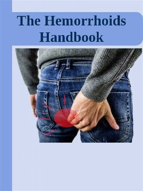 The Hemorrhoids Handbook Hemorrhoids Home Remedies Hemorrhoids