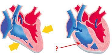 Diastology Part Ii Flashcards Quizlet