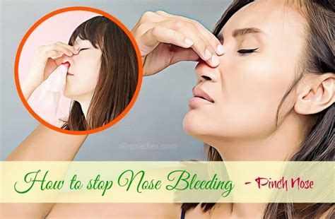 Top 14 Natural Home Remedies How To Stop Nose Bleeding Instantly