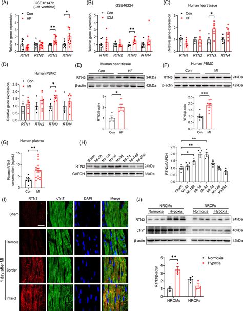 Reticulon 3 Deficiency Ameliorates Post Myocardial Infarction Heart