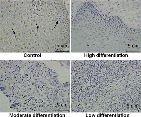 Pathway Focused Pcr Array Profiling Of Cal 27 Cell With Overexpressed