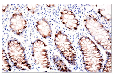 MUC2 CCP58 Mouse MAb Cell Signaling Technology