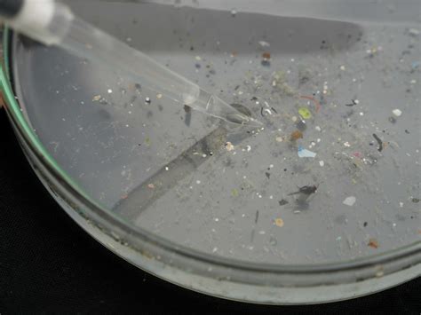 Microplastiche Gli Effetti Sulla Salute Umana In Uno Studio Cinese