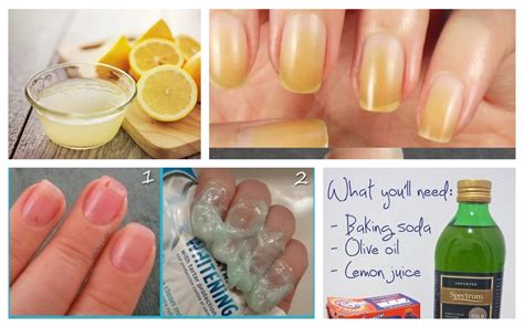 Effective Homemade Nail Whitening Ideas That You Should Try Now All