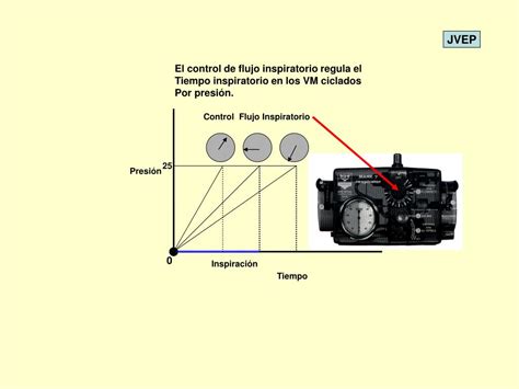 PPT Bases de la Ventilación Mecánica PowerPoint Presentation free