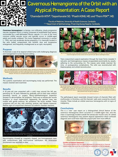 Pdf Cavernous Hemangioma Of The Orbit With An Atypical Presentation